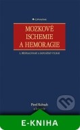 Mozkové ischemie a hemoragie - cena, porovnanie