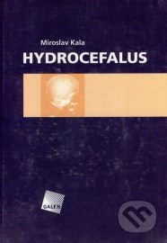 Hydrocefalus