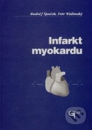 Infarkt myokardu - cena, porovnanie