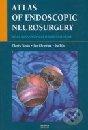 Atlas of Endoscopic Neurosurgery - cena, porovnanie