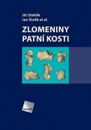 Zlomeniny patní kosti - cena, porovnanie