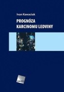 Prognóza karcinomu ledviny - cena, porovnanie