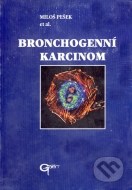 Bronchogenní karcinom - cena, porovnanie