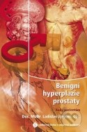 Benigní hyperplazie prostaty - cena, porovnanie