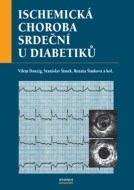 Ischemická choroba srdeční u diabetiků - cena, porovnanie