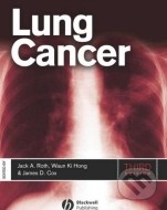 Lung Cancer - cena, porovnanie