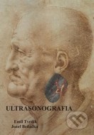 Ultrasonografia - cena, porovnanie