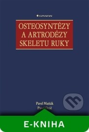 Osteosyntézy a artrodézy skeletu ruky