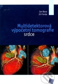 Multidetektorová výpočetní tomografie srdce