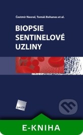 Biopsie sentinelové uzliny