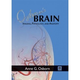 Osborn&#39;s Brain: Imaging, Pathology, and Anatomy