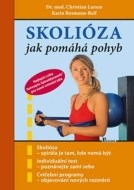 Skolióza - cena, porovnanie