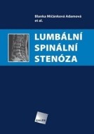 Lumbální spinální stenóza - cena, porovnanie