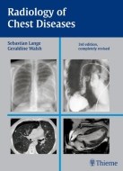 Radiology of Chest Diseases - cena, porovnanie