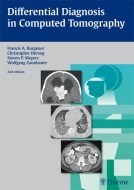 Differential Diagnosis in Computed Tomography - cena, porovnanie