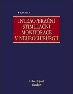 Intraoperační stimulační monitorace v neurochirurgii - cena, porovnanie