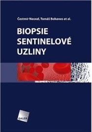 Biopsie sentinelové uzliny