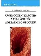 Onemocnění karotid a velkých cév aortálního oblouku - cena, porovnanie