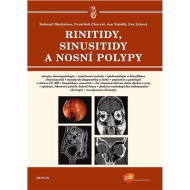 Rinitidy, sinusitidy a nosní polypy - cena, porovnanie