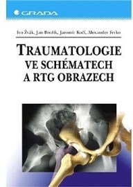 Traumatologie ve schématech a RTG obrazech