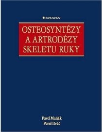 Osteosyntézy a artrodézy skeletu ruky