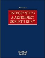 Osteosyntézy a artrodézy skeletu ruky - cena, porovnanie