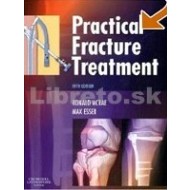 Practical Fracture Treatment - cena, porovnanie