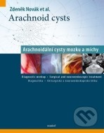 Arachnoid cysts