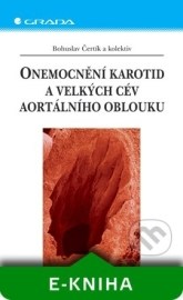 Onemocnění karotid a velkých cév aortálního oblouku