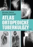 Atlas ortopedické tuberkulózy - cena, porovnanie