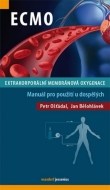 ECMO - Extrakorporální membránová oxygenace - cena, porovnanie