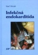 Infekčná endokarditída - cena, porovnanie