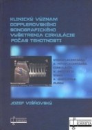 Klinický význam dopplerovského sonografického vyšetrenia cirkulácie počas tehotnosti - cena, porovnanie