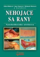 Nehojace sa rany - cena, porovnanie