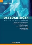 Osteoartróza - cena, porovnanie