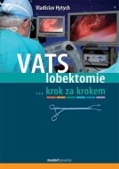 VATS lobektomie - cena, porovnanie