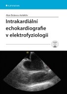 Intrakardiální echokardiografie v elektrofyziologii - cena, porovnanie