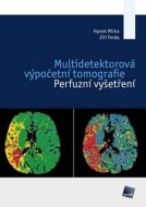 Multidetektorová výpočetní tomografie - cena, porovnanie