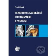 Femoroacetabulární impingement syndrom - cena, porovnanie