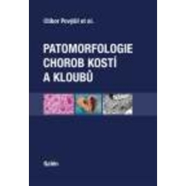 Patomorfologie chorob kostí a kloubů