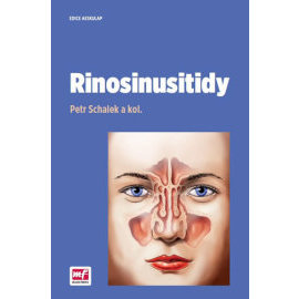 Rinosinusitidy