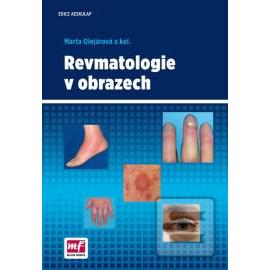 Revmatologie v obrazech