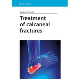 Treatment of Calcaneal Fractures