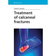 Treatment of Calcaneal Fractures - cena, porovnanie