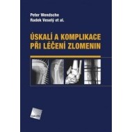 Úskalí a komplikace při léčení zlomenin - cena, porovnanie