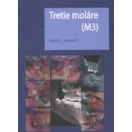 Tretie moláre (M3) - cena, porovnanie