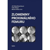 Zlomeniny proximálního femuru - cena, porovnanie