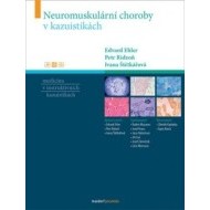 Neuromuskulární choroby v kazuistikách - cena, porovnanie