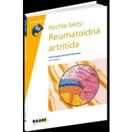 Rýchle fakty: Reumatoidná artritída