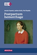 Postpartum hemorrhage - cena, porovnanie